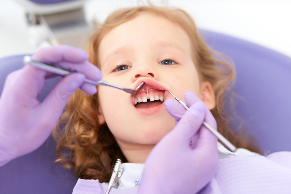 W Uzębieniu Stałym Jest Najwięcej Siekaczy Kiedy u dziecka powinny pojawić się stałe zęby? - Dentifem.pl